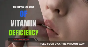 Could Your Chapped Lips Be a Sign of Vitamin Deficiency?