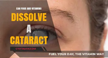 Exploring the Myth: Can Food and Vitamins Dissolve Cataracts?