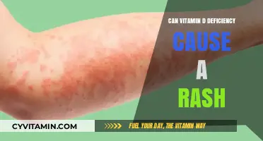 Exploring the Link: Can Vitamin D Deficiency Trigger Skin Rashes?