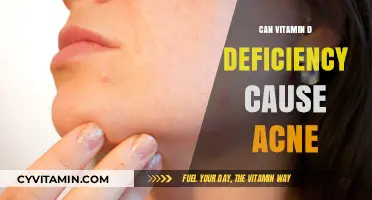 Exploring the Link: Can Vitamin D Deficiency Trigger Acne?