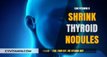 Exploring the Link: Can Vitamin D Help Shrink Thyroid Nodules?
