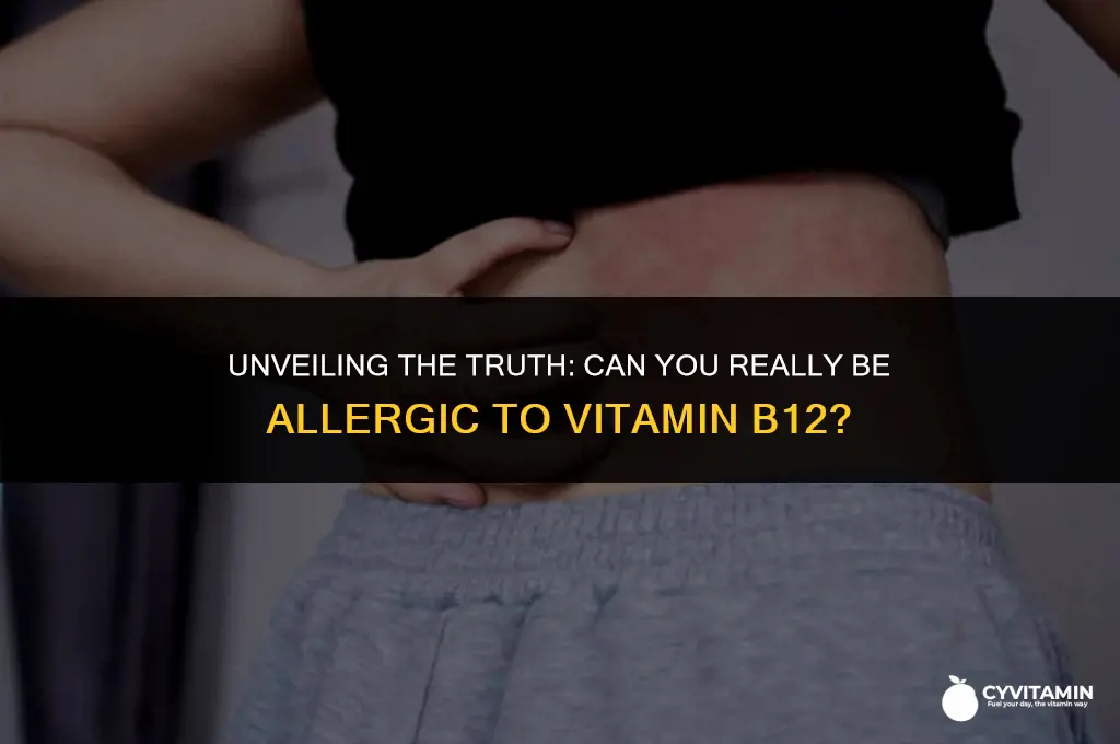 can you be allergic to vitamin b12