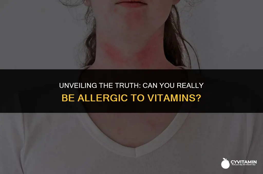 can you be allergic to vitamins