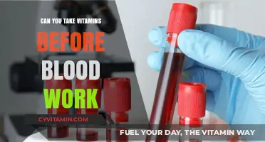 Should You Take Vitamins Before Blood Work? Expert Insights