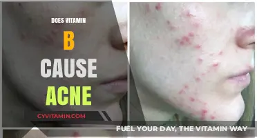 Unveiling the Truth: Does Vitamin B Really Trigger Acne?