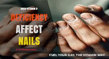 Exploring the Link: Vitamin D Deficiency and Nail Health