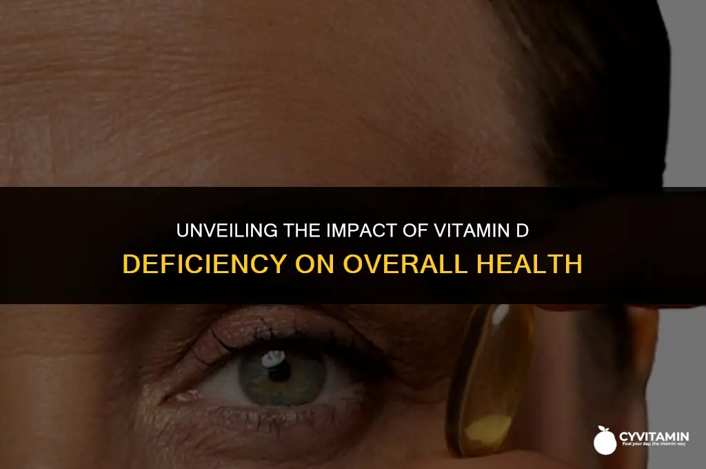 does vitamin d deficiency cause