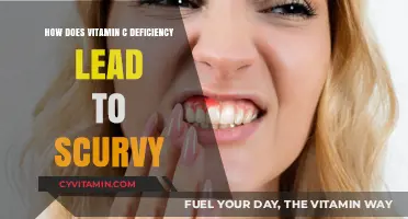 From Deficiency to Disease: Understanding How Vitamin C Leads to Scurvy