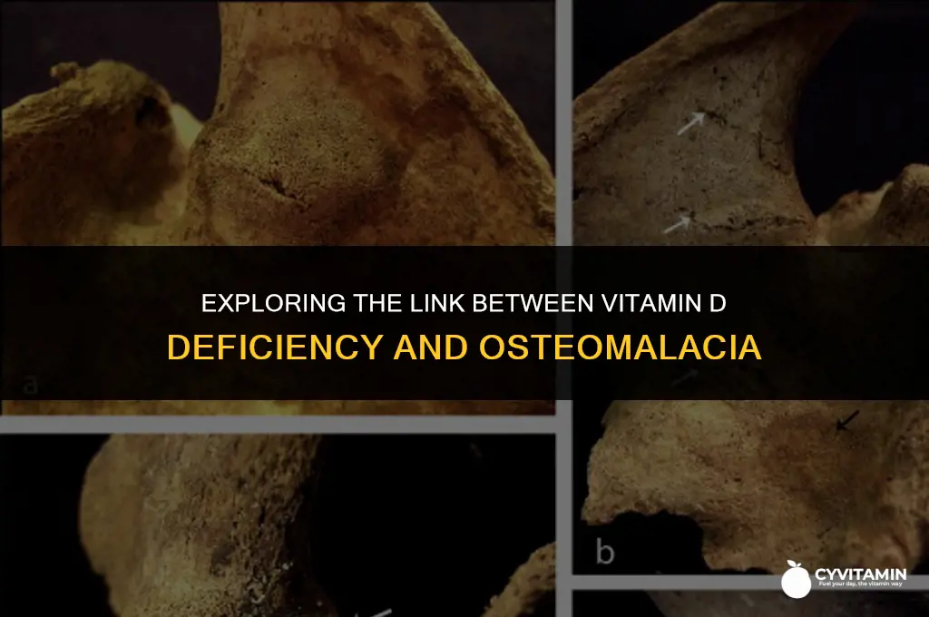 how is vitamin d deficiency related to osteomalacia