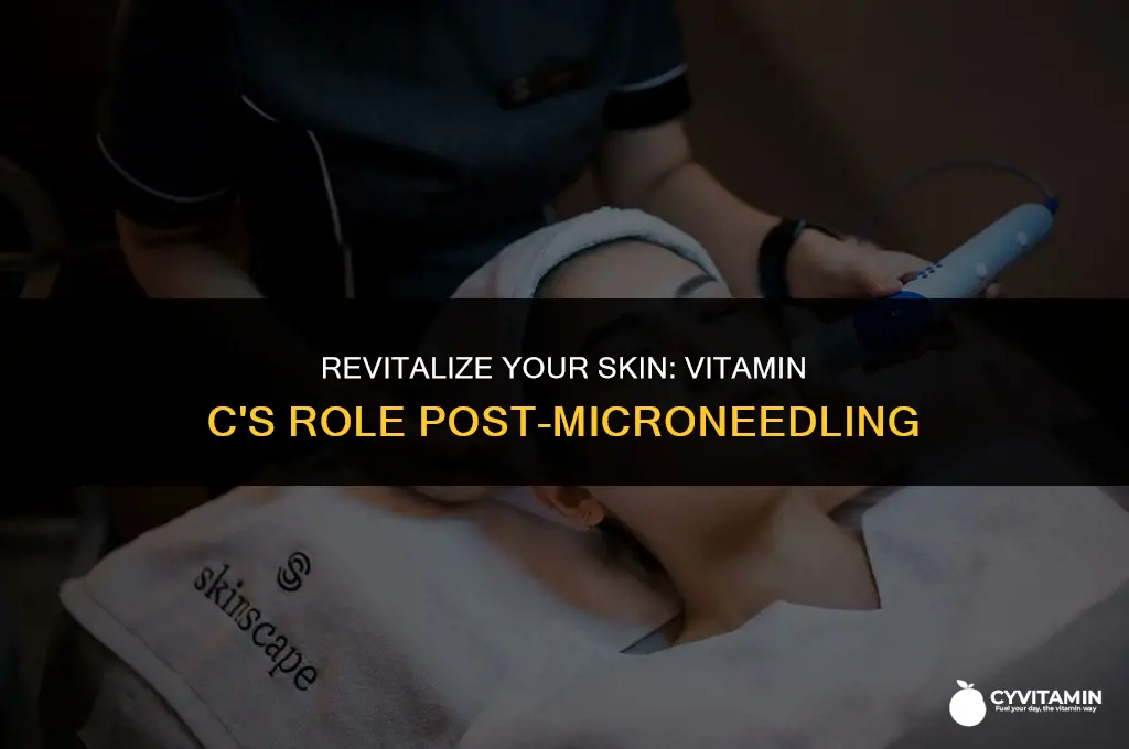 how long after microneedling can i use vitamin c