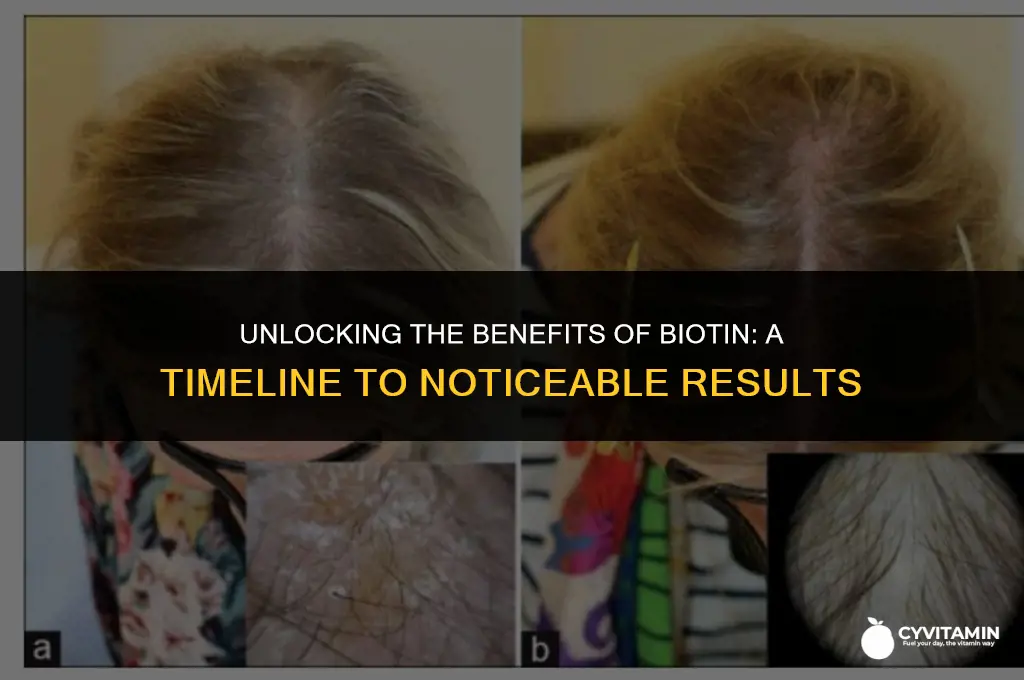 how long does it take for biotin vitamins to work