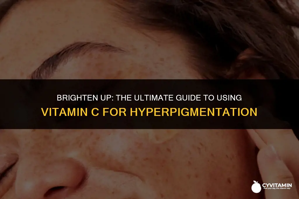 how to use vitamin c for hyperpigmentation