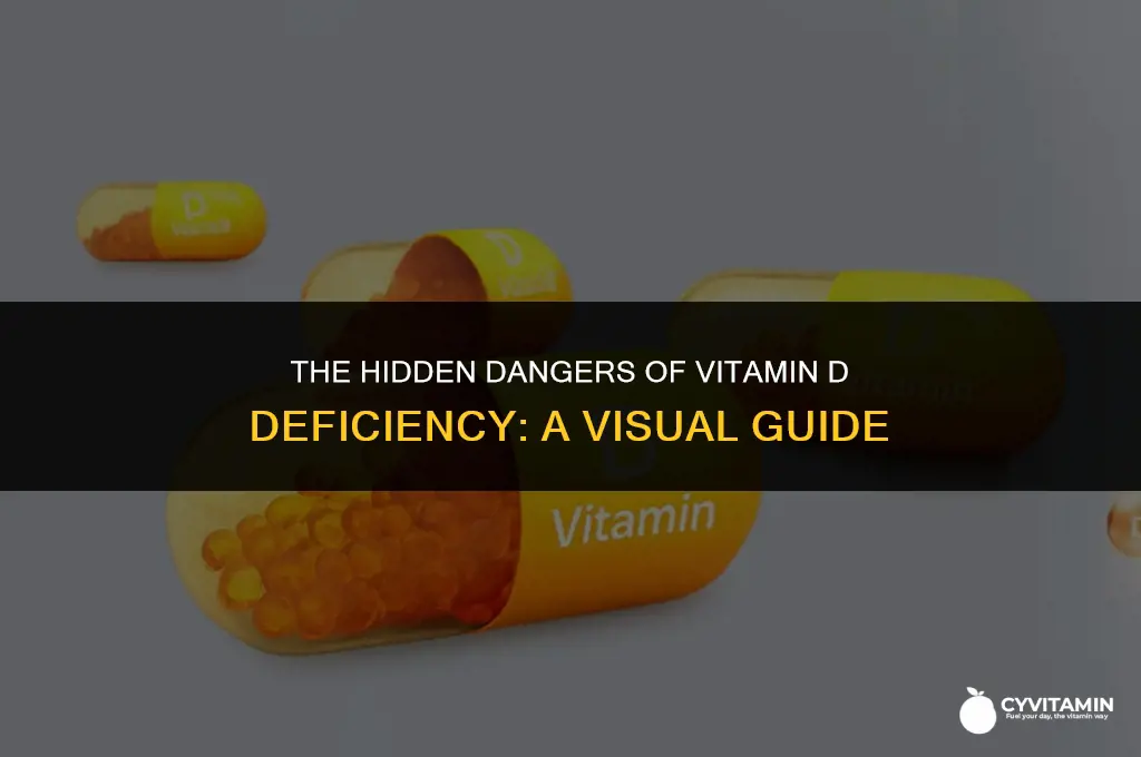 is a vitamin d deficiency bad visial