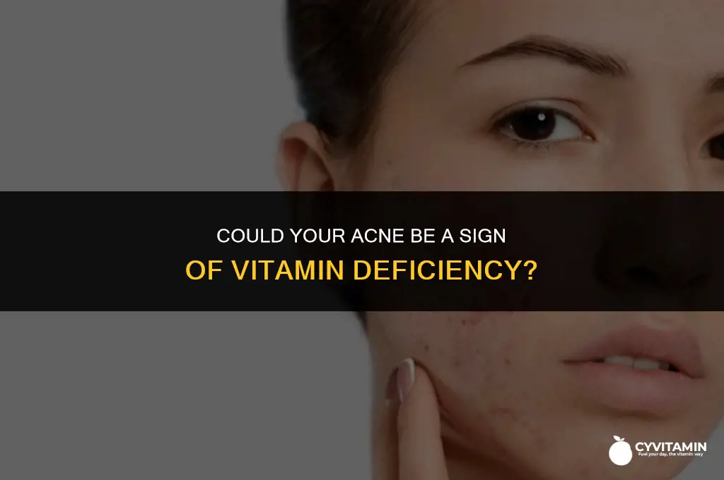 is acne a sign of vitamin deficiency