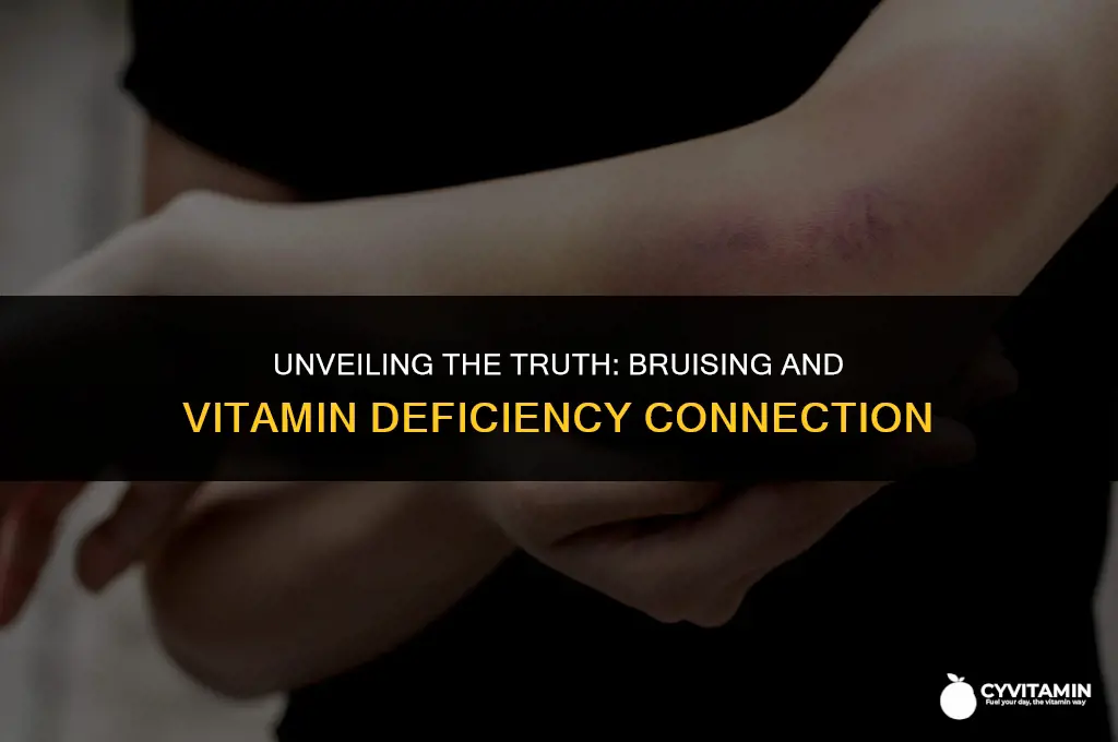is bruising a sign of vitamin deficiency