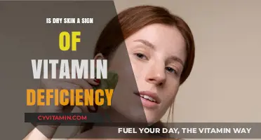 Could Your Dry Skin Be a Sign of Vitamin Deficiency?