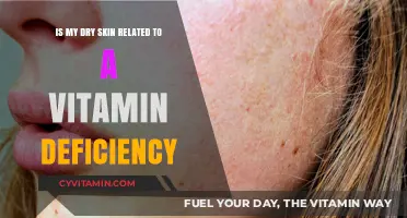 Could Your Dry Skin Be a Sign of Vitamin Deficiency?