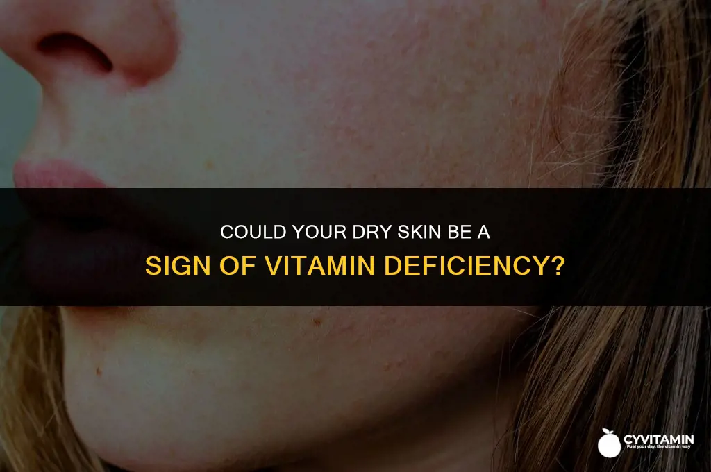 is my dry skin related to a vitamin deficiency