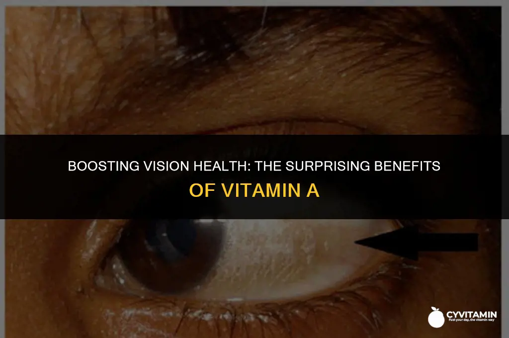 is vitamin a good for your eyes