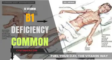 Unveiling the Truth: How Common is Vitamin B1 Deficiency?