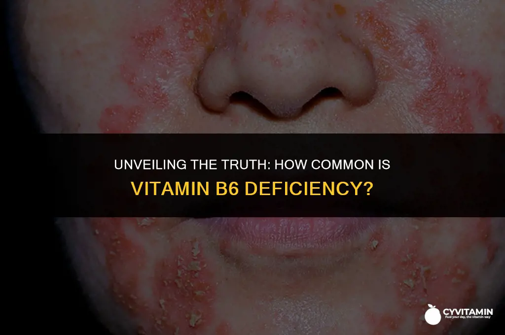 is vitamin b6 deficiency common