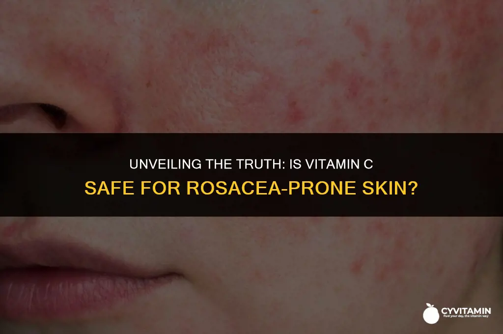 is vitamin c bad for rosacea