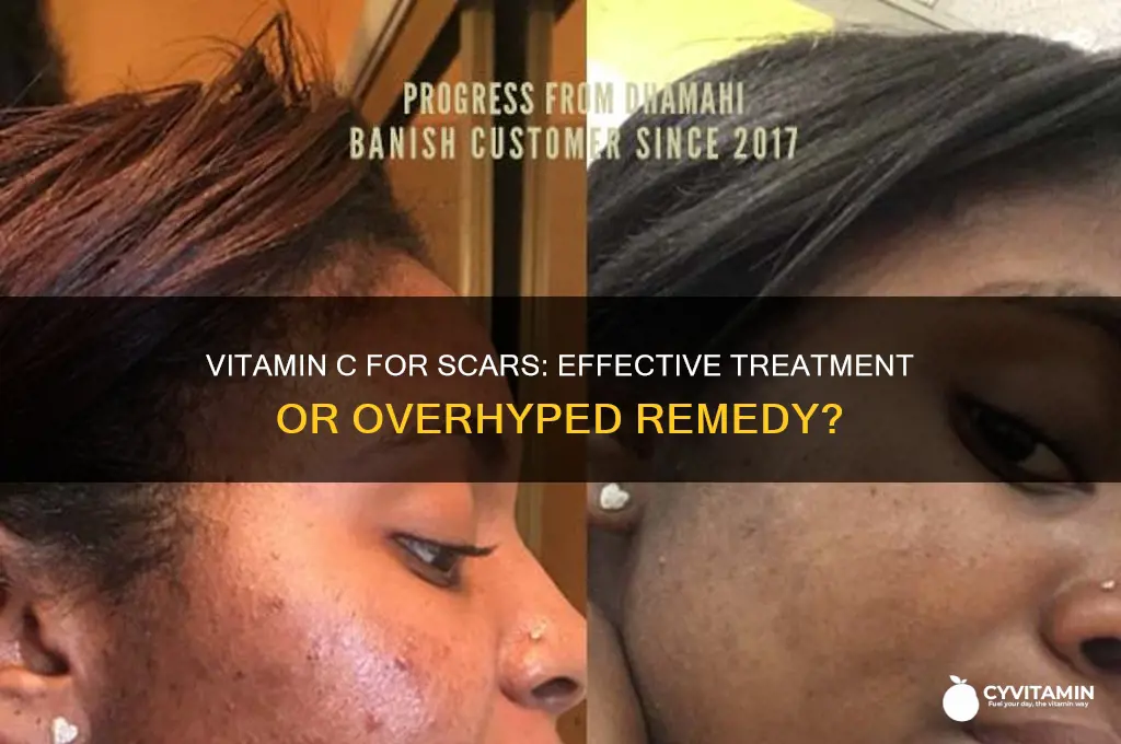 is vitamin c best for scaring