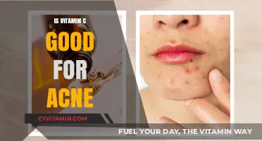 Unveiling the Truth: Vitamin C's Role in Acne Treatment