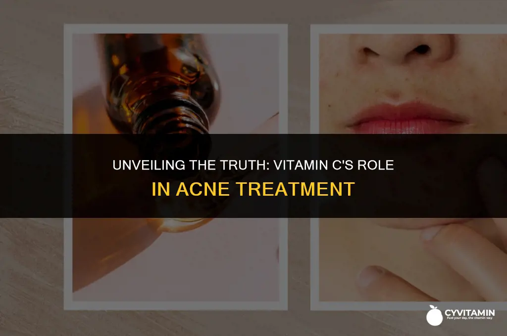 is vitamin c good for acne