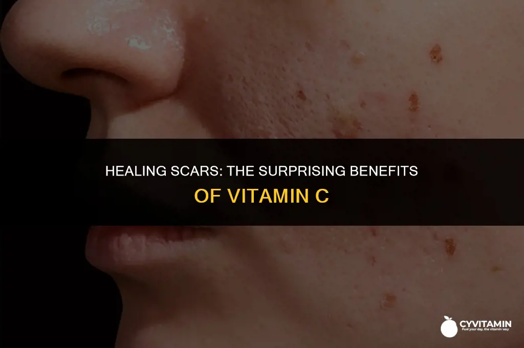 is vitamin c good for scars