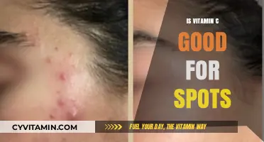 Vitamin C for Acne: Does It Really Work?