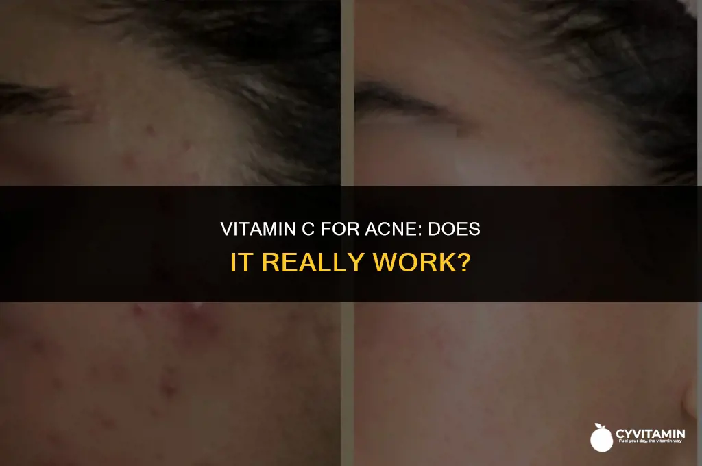 is vitamin c good for spots
