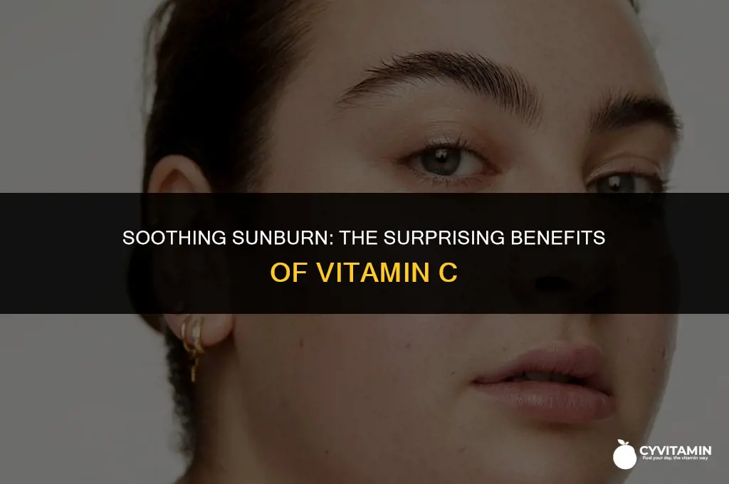 is vitamin c good for sunburn