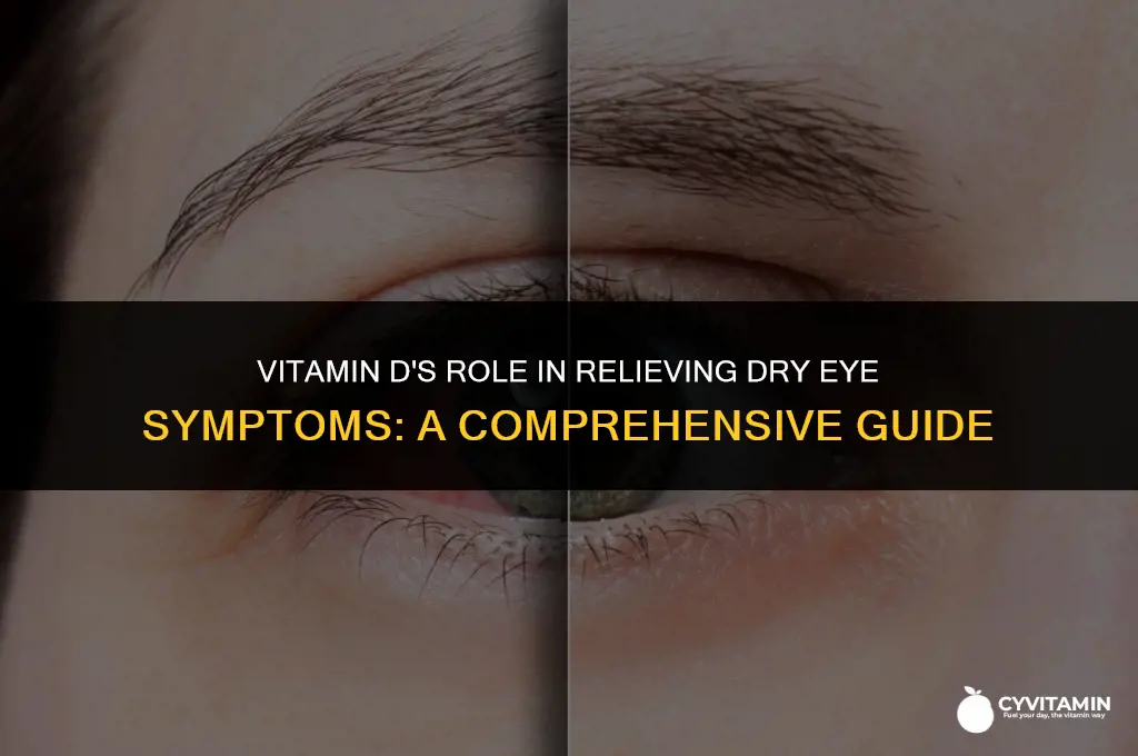 is vitamin d good for dry eyes