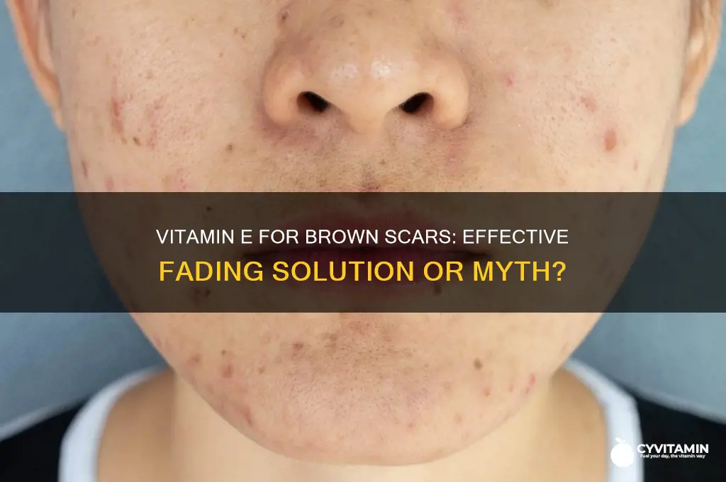 is vitamin e best for fading brown scars