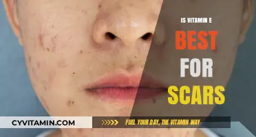 Vitamin E for Scars: Effective Treatment or Overhyped Remedy?