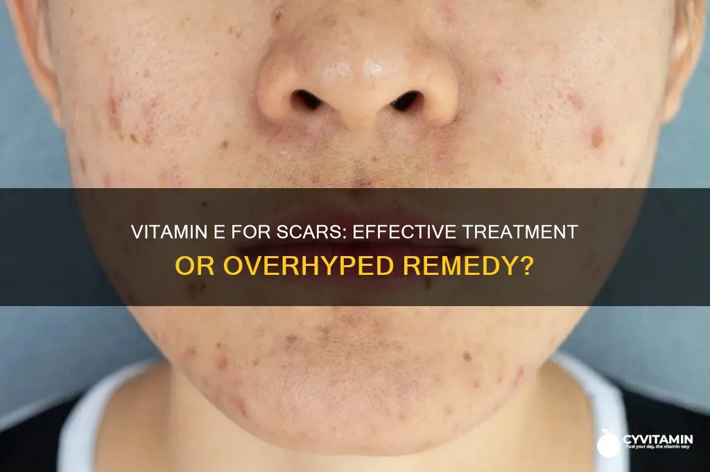 is vitamin e best for scars