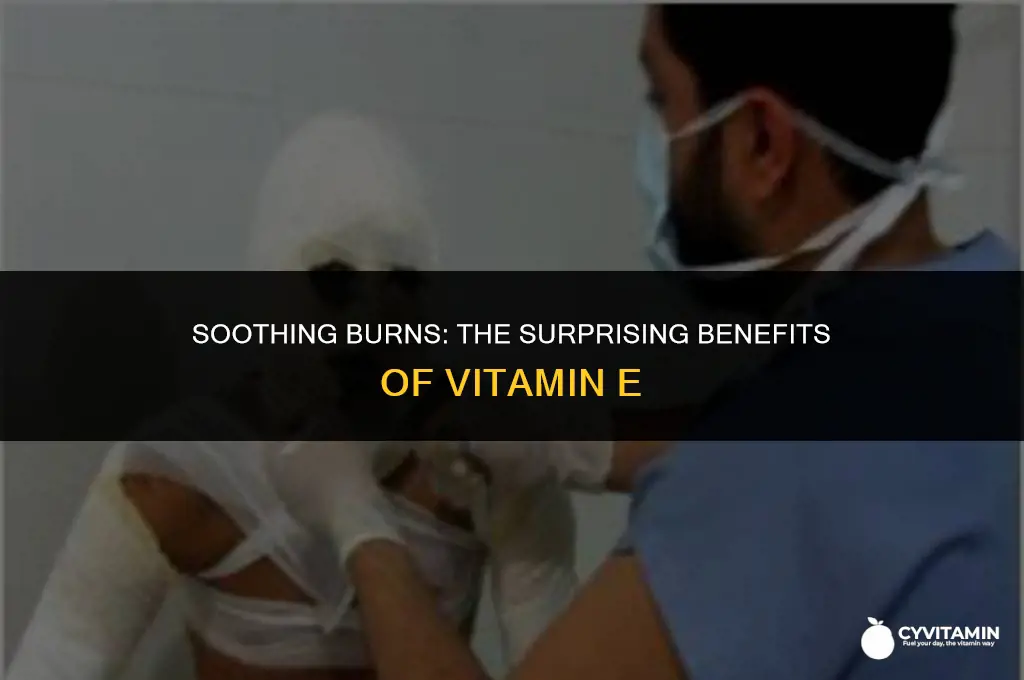 is vitamin e good for a burn