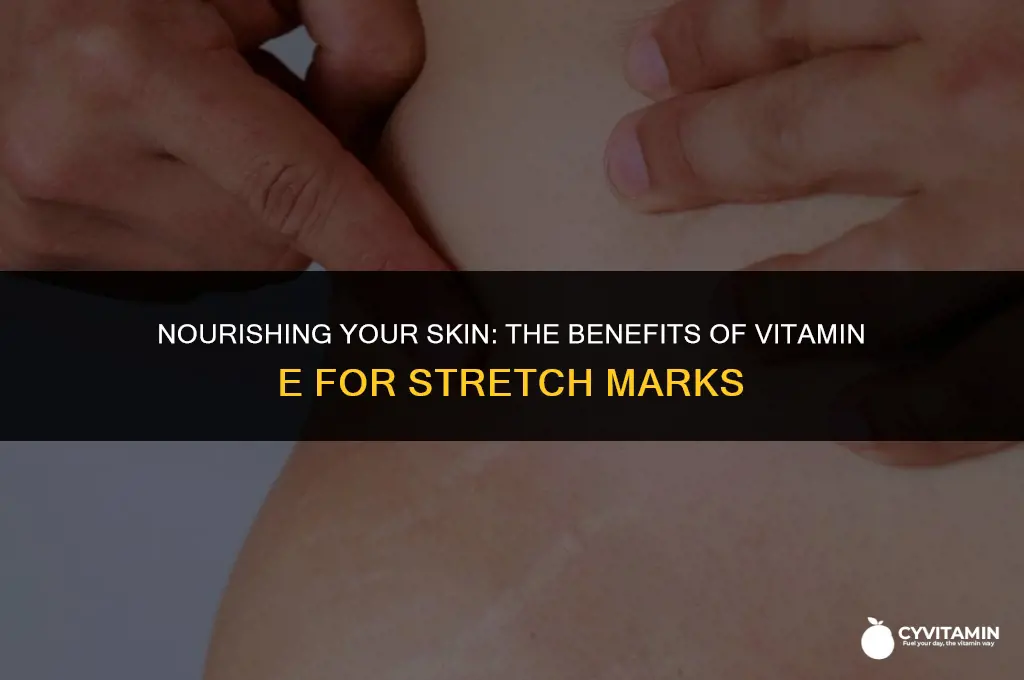 is vitamin e good for stretch marks