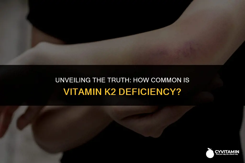 is vitamin k2 deficiency common