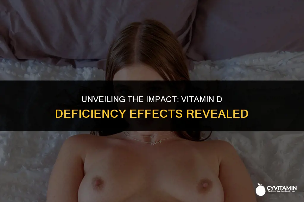 what are effects of vitamin d deficiency