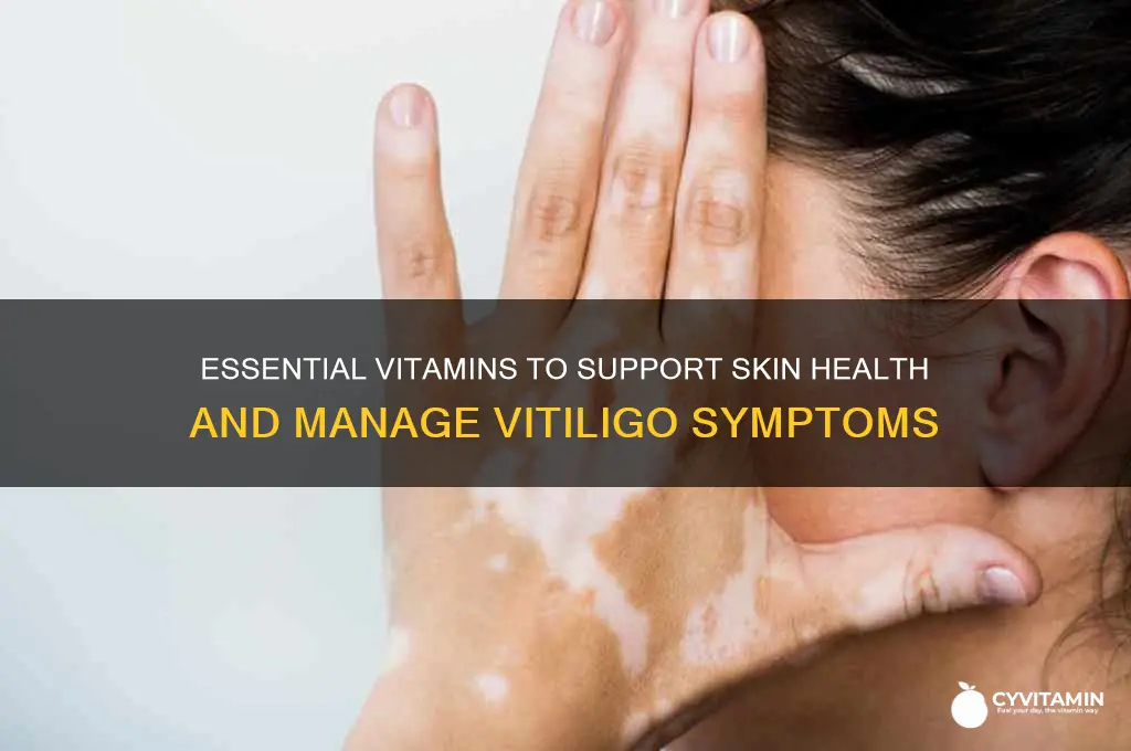 what are the best vitamins for vitiligo