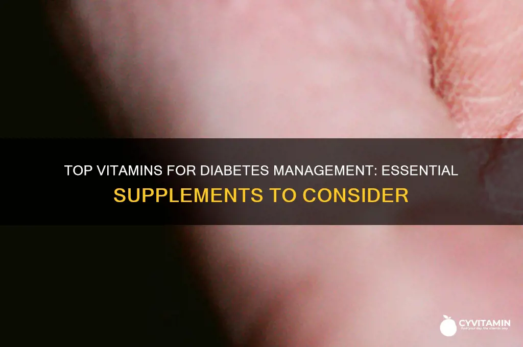 what are the best vitamins to take for diabetes