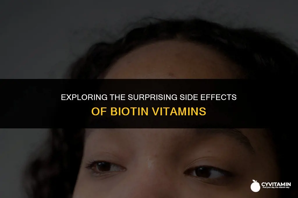 what are the side effects of biotin vitamins