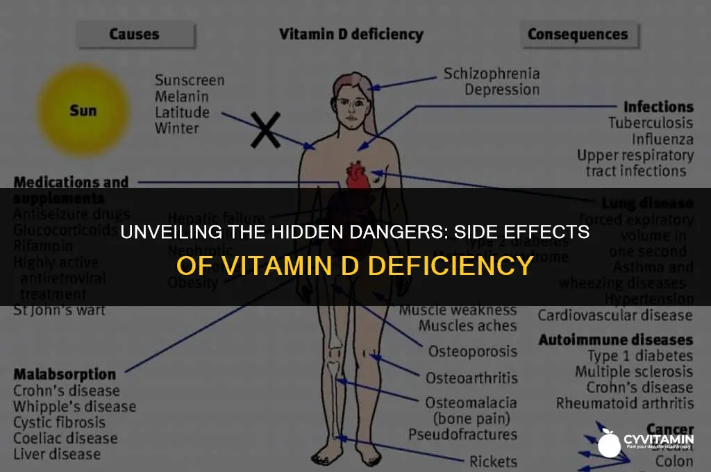 what are the side effects of vitamin d deficiency