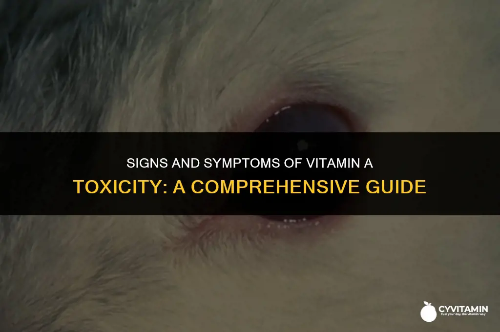 what are the symptoms of vitamin a toxicity