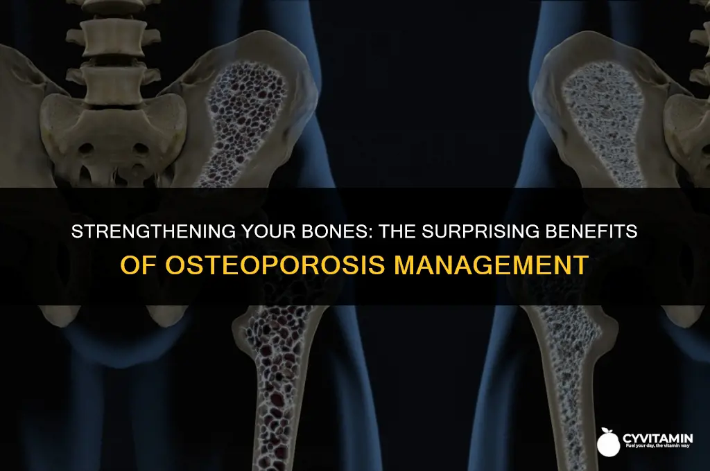 what benefits can i get if i have osteoporosis