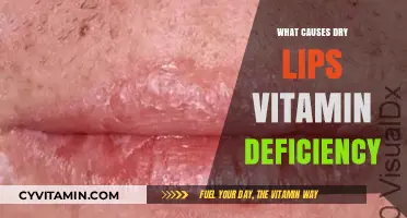 Unveiling the Culprits: Vitamin Deficiencies That Cause Dry Lips