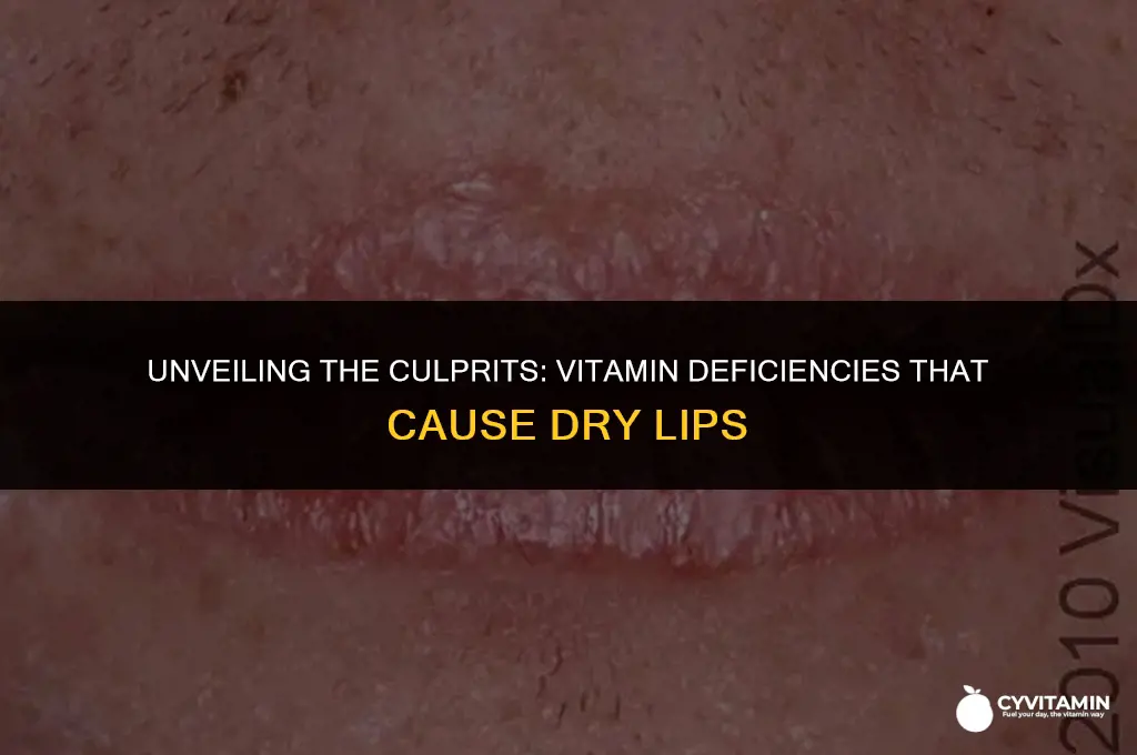 what causes dry lips vitamin deficiency