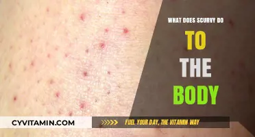 The Devastating Effects of Scurvy on the Human Body